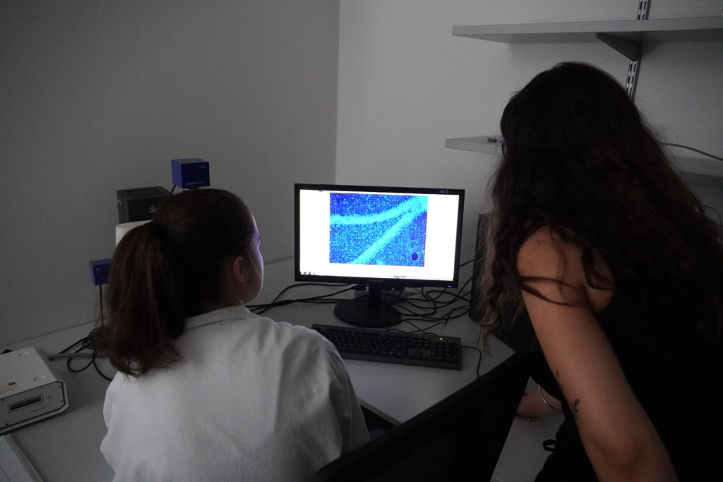 Pozorovanie rezov mozgu pod fluorescenčným mikroskopom.