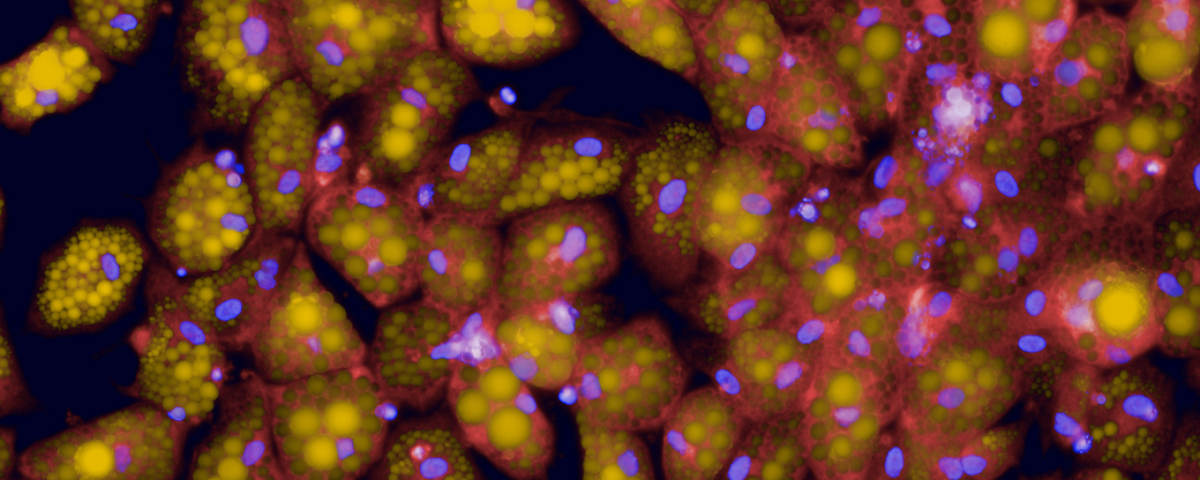 Staining of fat droplets (yellow), nuclei (blue) and cytosol (red) in human beige adipose cells.