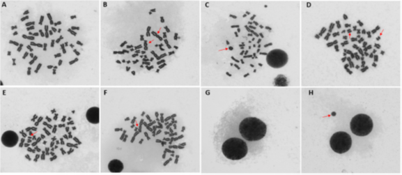 Metaphase chromosomes on which we observed the level of genetic instability in humans living near base stations: normal metaphase without signs of damage (A); examples of different chromosomal aberrations such as dicentric chromosomes (B), circular chromosome (C), acentric chromosome (D), chromosomal fragments (E) and chromatid gap (F). Micronucleus assay for the determination of permanent DNA damage. Binucleated cells blocked in the process of cell division, arrest of cellular but not nuclear division produces binucleated cells (G), representative image of a micronucleus (H).